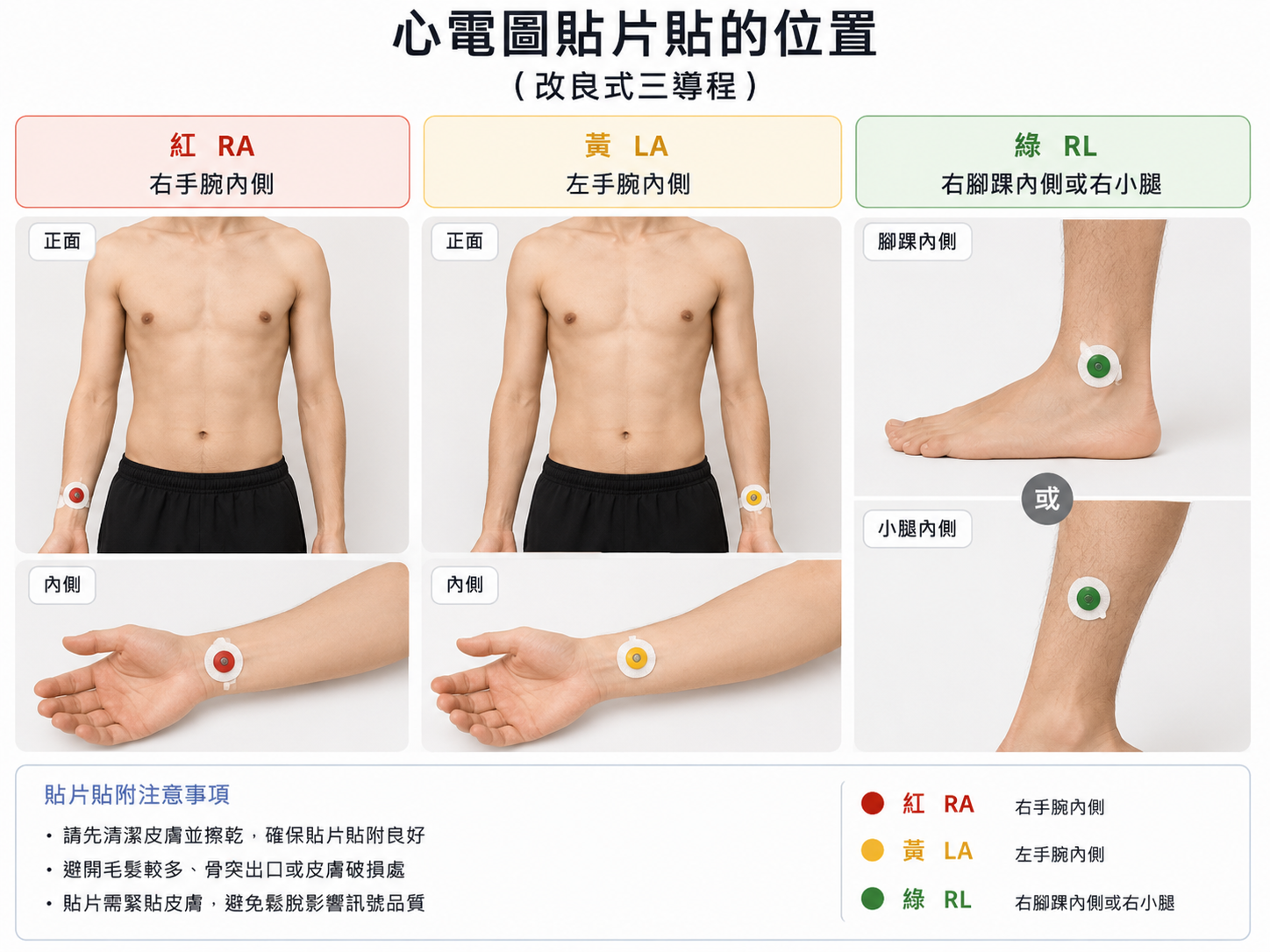 貼法 B：改良式三導程，貼在手腕與腳踝